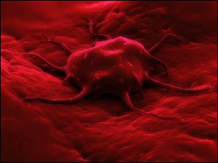 cancer cell